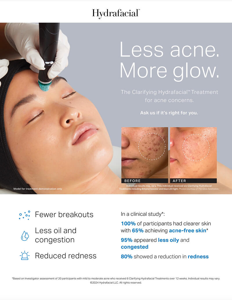 Dothan hydrafacial infographic